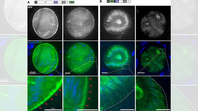 TRP1_GFP_lokalisiert_an_der_Oocystenwand_waehrend_GFP_TRP1N_sich_im_ERanreichert.jpg TRP1-GFP