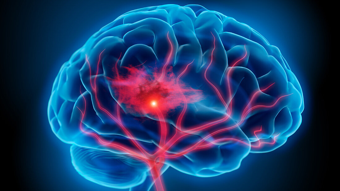 Mobile_Stroke_Unit_Datenauswertung.jpg Mobile_Stroke_Unit_Datenauswertung.jpg