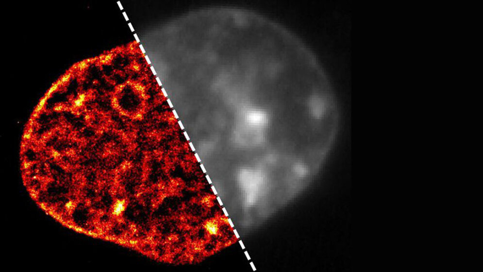 Aus der Forschung Ausgehungerte Zellen verdichten ihre DNA