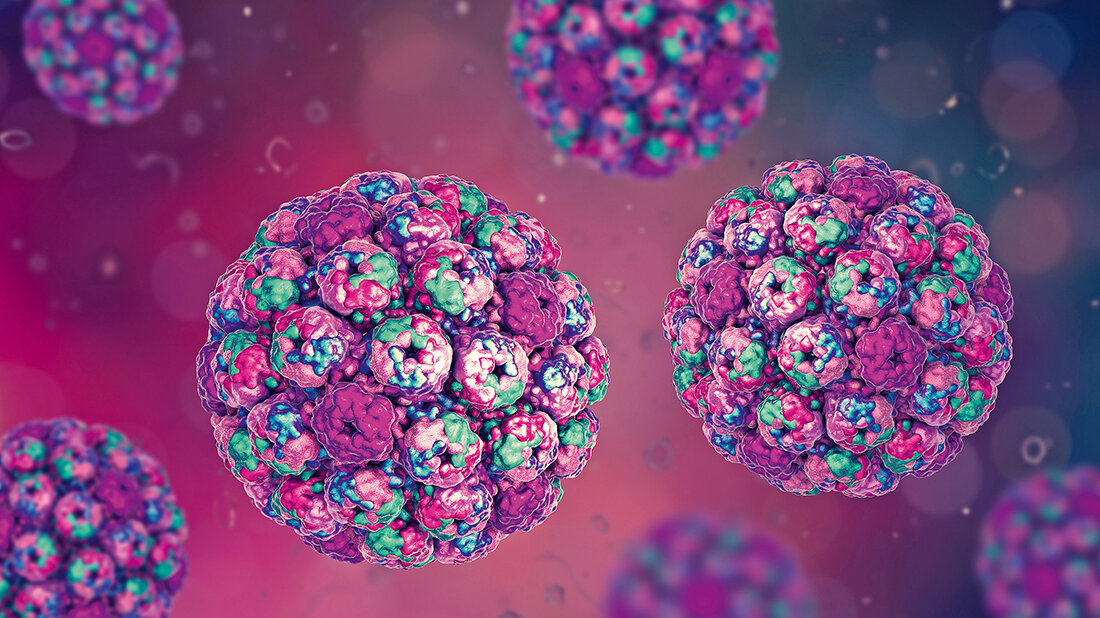 Merkelzell-Polyomavirus Titelbild zum Fachbeitrag über das Merkelzell-Polyomavirus
