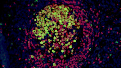 Darstellung_eines_Lymphfollikels_mittels_Immunfluoreszenz_FU_Berlin_Kristina_Dietert.jpg Darstellung eines Lymphfollikels