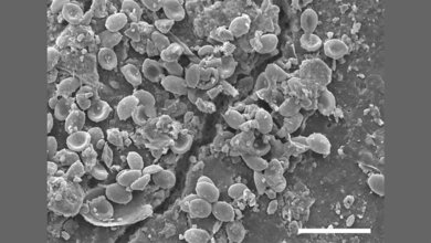 Pilzsporen_entlang_eines_Risses_in_einem_Mikroplastikpartikel_UBT_Abt_Mykologie.jpg Pilzsporen entlang eines Risses