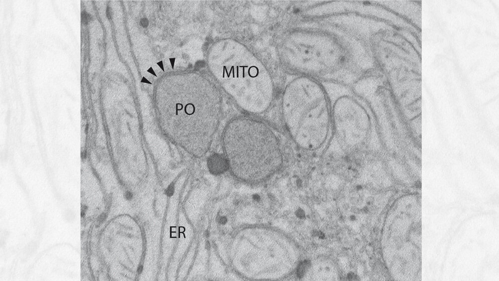 Ausschnitt_aus_einer_Leberzelle_der_Ratte_UMM.jpg Ausschnitt aus einer Leberzelle der Ratte