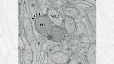 Ausschnitt_aus_einer_Leberzelle_der_Ratte_UMM.jpg Ausschnitt aus einer Leberzelle der Ratte