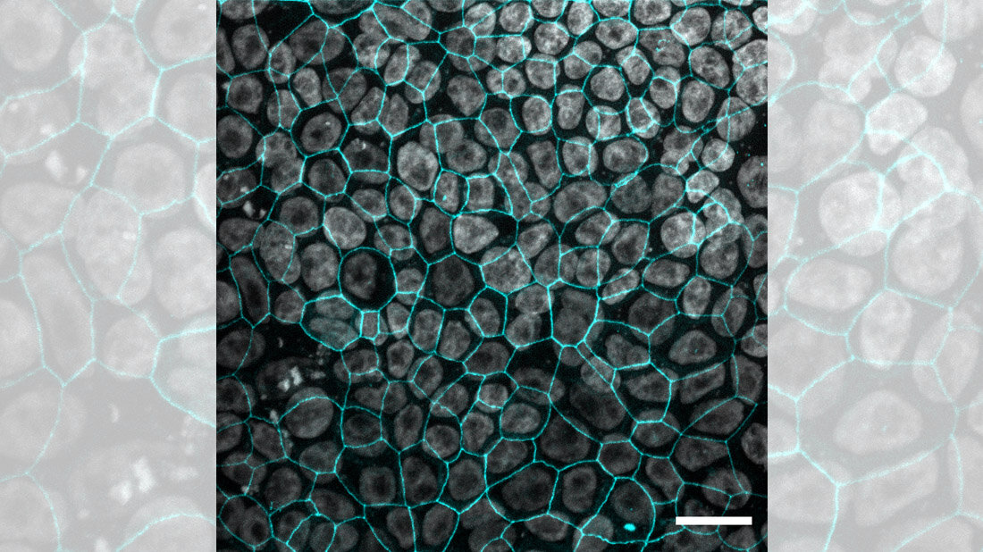 Fluoreszenzfaerbung_von_Arlo_Zellen.jpg Fluoreszenzfärbung von Arlo-Zellen