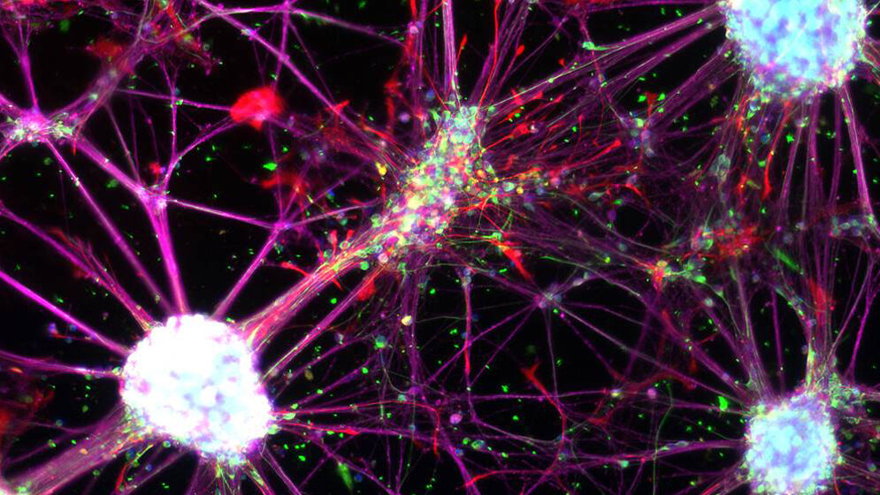 Netzwerk_aus_neuralen_Stammzellen_MC_Thier_DKFZ.jpg Netzwerk aus neuralen Stammzellen