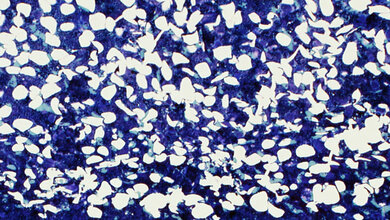 Schneegestoeber_im_Knochen_Foto_Uniklinikum_Dresden_Dr_Ann_Kristin_Picke.jpg Ersatz von Knochenmark