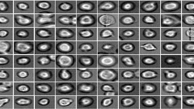 Blutstammzellen_unter_dem_Mirkroskop_Helmholtz_Zentrum_Muenchen.jpg Blutstammzellen