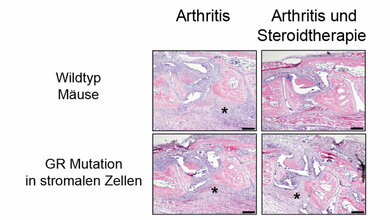 Histologische_Untersuchungen_von_arthritischen_Wildtyp_Maeusen_Abbildung_Institut_fuer_Molekulare_Endokrinologie_der_Tiere.jpg Histologische_Untersuchungen_von_arthritischen_Wildtyp_Maeusen_Abbildung_Institut_fuer_Molekulare_Endokrinologie_der_Tiere.jpg