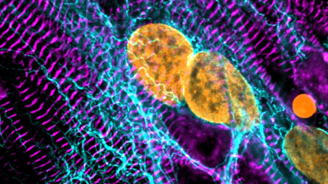 Stammzell-kardiomyozyten.jpg Stammzell-Kardiomyozyten