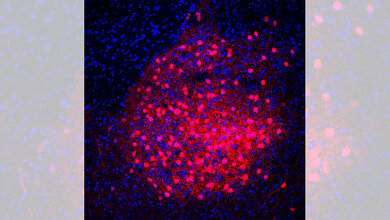 CRH_Neuronen_des_zentralen_Mandelkerns_MPI_für_Psychiatrie.jpg CRH Neuronen (rot) im Mandelkern