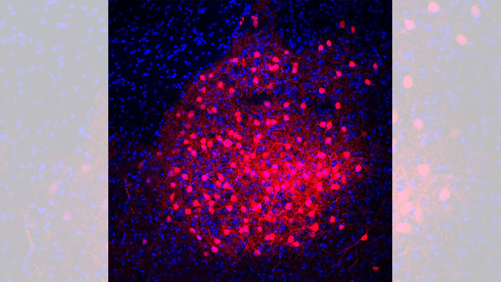CRH_Neuronen_des_zentralen_Mandelkerns_MPI_für_Psychiatrie.jpg CRH Neuronen (rot) im Mandelkern