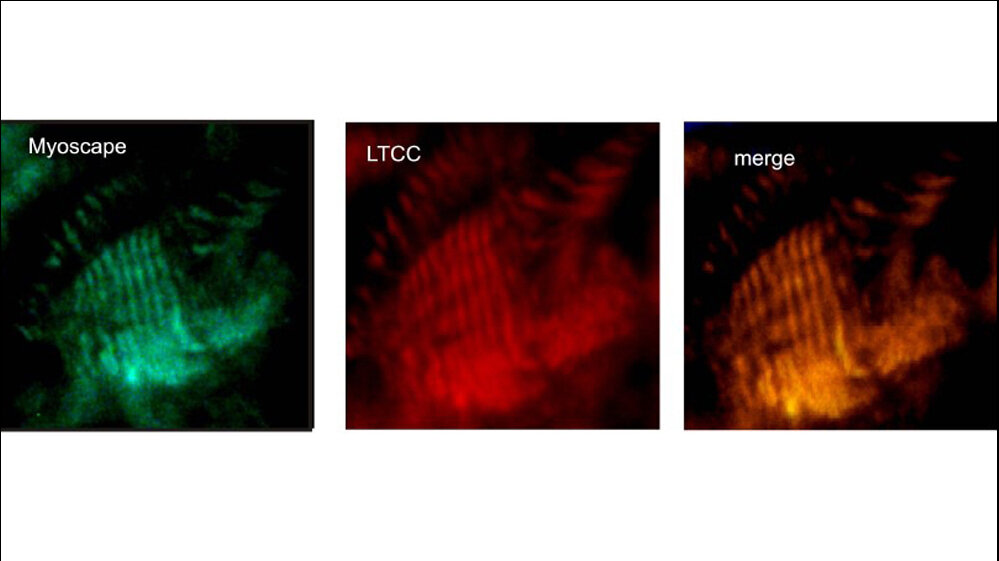 FluoreszenzmarkierteAntikorper_FotoCopyright_Klinik_fuer_Innere_Medizin_29042016.jpg Myoscape