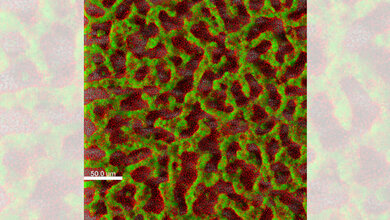 Krankenhauskeim_Pseudomonas_aeruginosa_TWINCORE_Janne_Thoeming.jpg Der Krankenhauskeim Pseudomonas aeruginosa