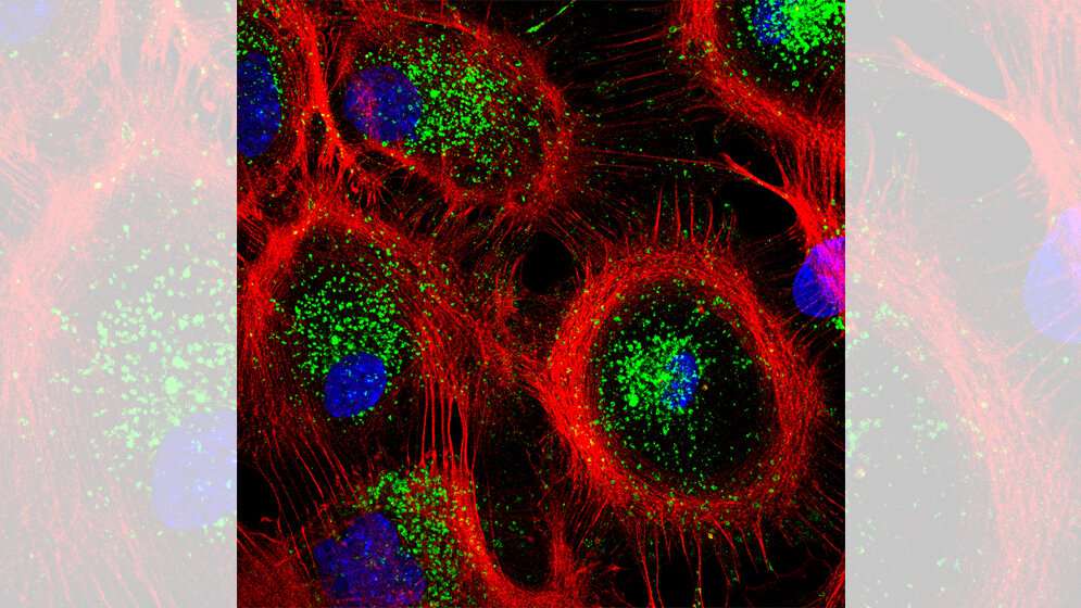 Aufnahme_von_Astrozyten_aus_der_Maus_Tania_Lopez_Hernandez_FMP.jpg Aufnahme von Astrozyten aus der Maus