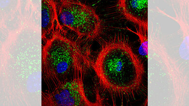 Aufnahme_von_Astrozyten_aus_der_Maus_Tania_Lopez_Hernandez_FMP.jpg Aufnahme von Astrozyten aus der Maus