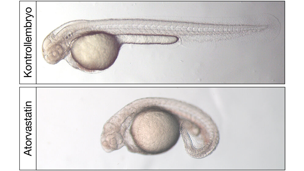 Lichtmikroskopische_Aufnahme_von_zwei_Tage_alten_Zebrafischembryonen_Lars_Maerz.jpg Lichtmikroskopische Aufnahme von zwei Tage alten Zebrafischembryonen.