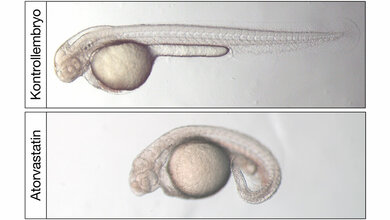 Lichtmikroskopische_Aufnahme_von_zwei_Tage_alten_Zebrafischembryonen_Lars_Maerz.jpg Lichtmikroskopische Aufnahme von zwei Tage alten Zebrafischembryonen.
