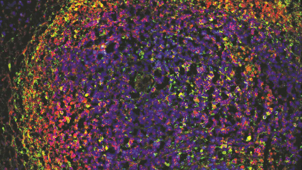 T_Zelllymphom_DKFZ_Anne_Schroeder_Karin_Mueller_Decker_15082016.jpg Immunfluoreszenzfärbung