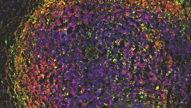T_Zelllymphom_DKFZ_Anne_Schroeder_Karin_Mueller_Decker_15082016.jpg Immunfluoreszenzfärbung