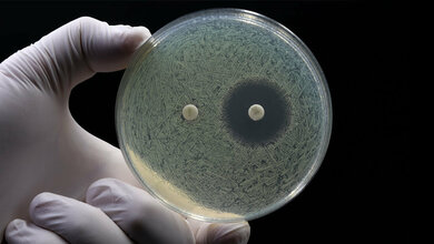 Antibiotikaresistenzen_nehmen_zu.jpg Test auf Antibiotikaresistenz