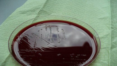 Aktuelles zu Clostridium difficile Labordiagnostik