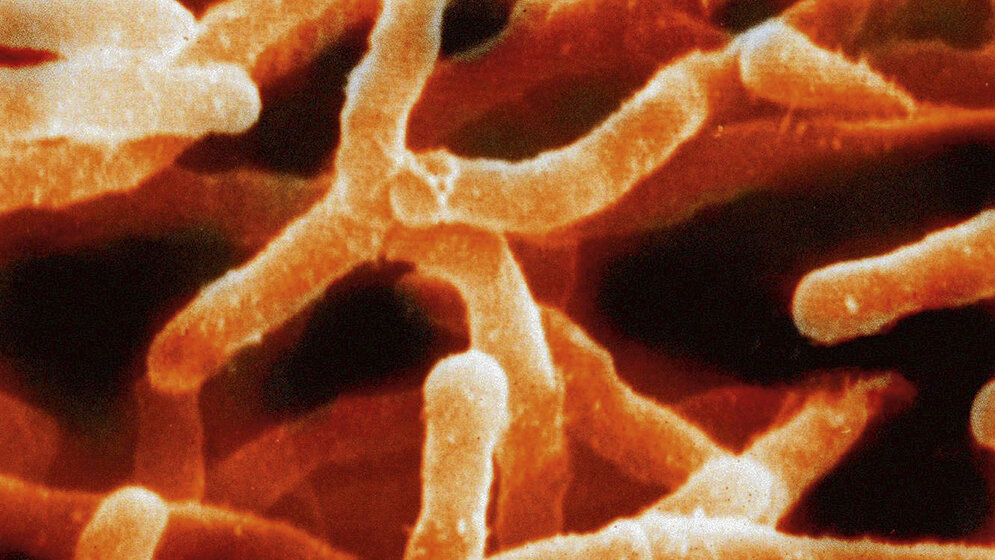 Aktinomykose Schnittbilddiagnostik der Wirbelsäule