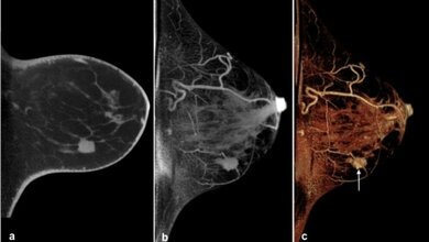 ConeBeam_Brust_CT_Fa_Koning_Nativuntersuchung_diagnostisches_Brustzentrum_Goettingen_28042016.jpg Cone-Beam Brust-CT