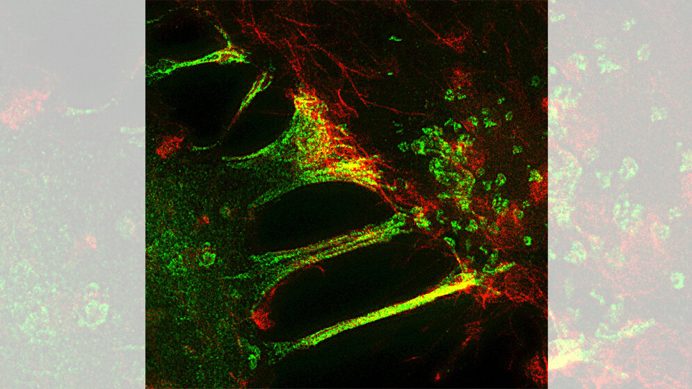 Knabbern_von_Zellen_MPI_für_Neurobiologie_Gong_J_Cell_Biol_2019.jpg Wenn Zellen zu „Kannibalen“ werden