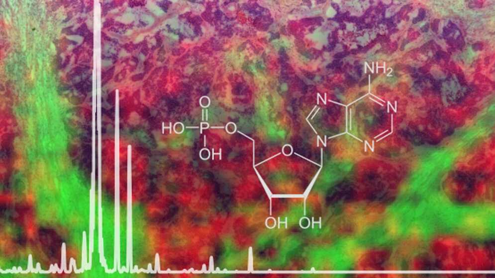 Protokoll_Helmholtz_Zentrum_Muenchen_19072016.jpg neues Protokoll für die bildgebende Massenspektrometrie