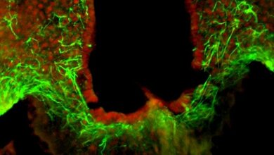 HDAC5_rot_umliegende_Astrozyten_gruen_eingefaerbt_HZM_29022016.jpg HDAC5