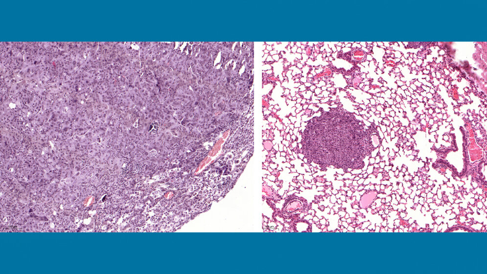 Links_ein_Lungentumor_der_USP28_exprimiert_Bilder_Markus_Diefenbacher.jpg Links ein Lungentumor, der USP28 exprimiert