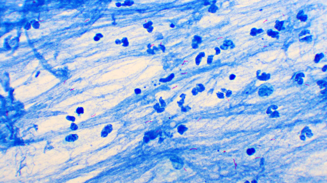 Tuberkulose_Mikroskop.jpg Mycobacterium tuberculosis