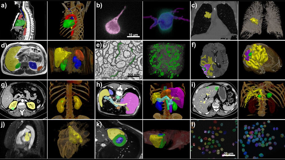 nnU-Net_verarbeitet_eine_Vielzahl_von_Datensätzen_und_Bildeigenschaften_Isensee_et_al_Nature_Methods.jpg nnU-Net verarbeitet eine Vielzahl von Datensätzen und Bildeigenschaften.