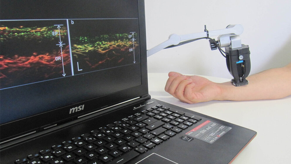 Gewebescanner_erlaubt_Blick_unter_die_HautQuelle_Helmholtz_Zentrum_Muenchen.jpg neu entwickelter Gewebescanner