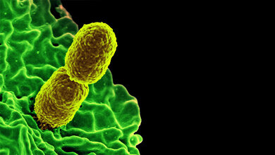 2_Carbapenem_resistente_Klebsiella_pneumoniae_Bakterien_NIAID_public_domain.jpg Carbapenem-resistente Klebsiella pneumoniae