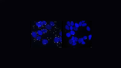 Ankerprotein_G3BP1_Marti_Cadena_Sandoval_UIBK_Innsbruck.jpg Ankerprotein G3BP1