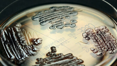 Multiresistente_Enterobakterien_IMMIH_Koeln_Hamprecht.jpg Multiresistente Enterobakterien