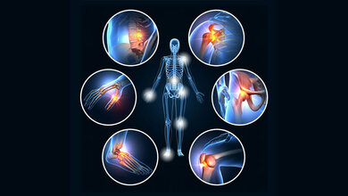 Rheuma_neues_Diagnosetool.jpg Schaubild für Rheuma