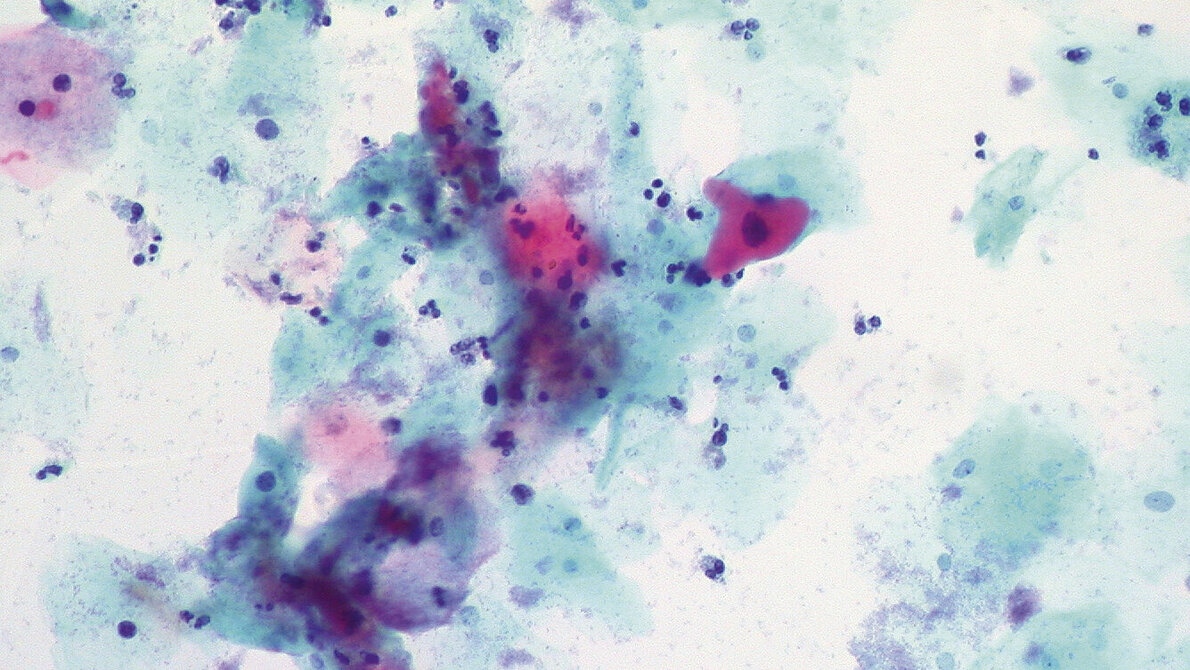 Humane Papillomaviren Mikrobiologie