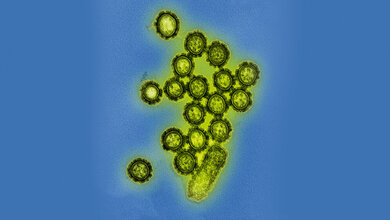 Epidemiologie Vor 100 Jahren forderte die Spanische Grippe Millionen Tote (2)