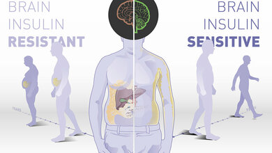 Die_Insulinwirkung_im_Gehirn_bestimmt_das_Koerpergewicht_IDM_DZD.jpg Insulinwirkung im Gehirn