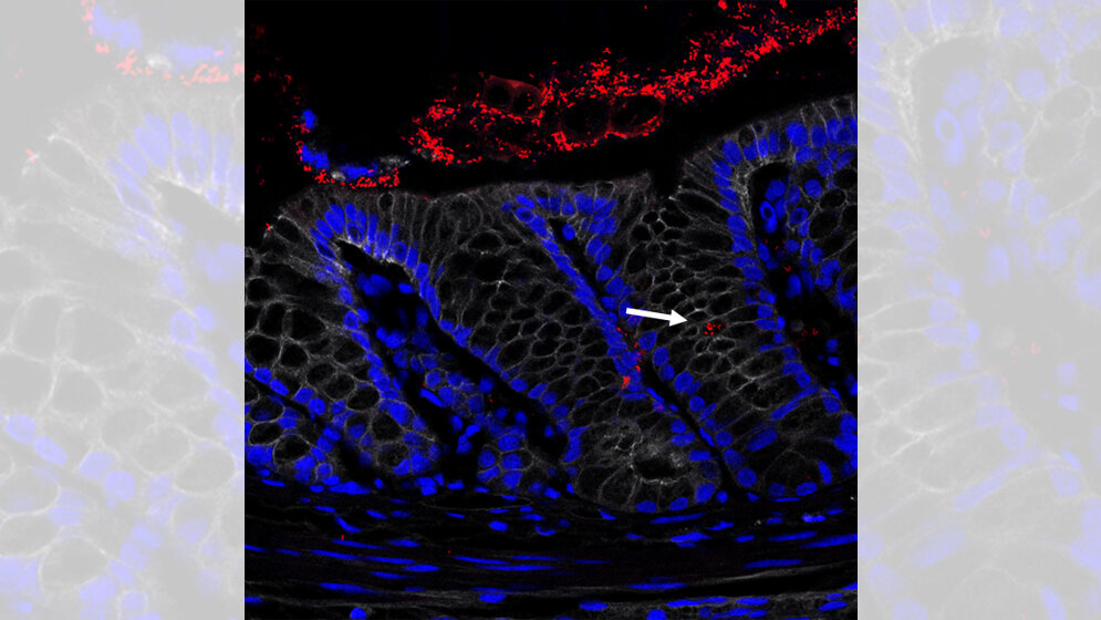 Querschnitt_eines_entzuendeten_Dickdarms_Sigal_charite.jpg Querschnitt eines entzündeten Dickdarms