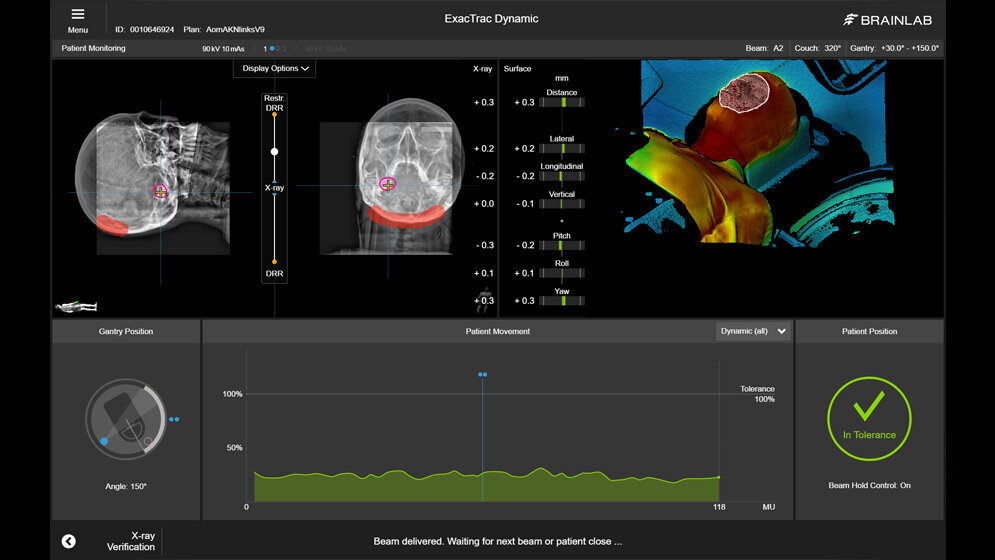 ExacTrac_Dynamic_Patient_Montoring_Quelle_LMU_Klinikum.jpg ExacTrac Dynamic Patient Montoring