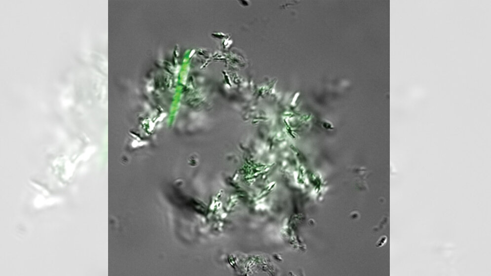 Mycobacterium_tuberculosis_Zellen_Mireille_Kamariza_Stanford_University.jpg Mycobacterium tuberculosis-Zellen