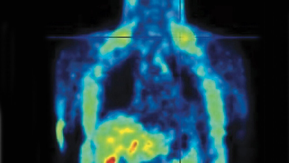PET_EMBO_Molecular_Management_CC_BY_4_0_16062016.jpg PET-Aufnahme
