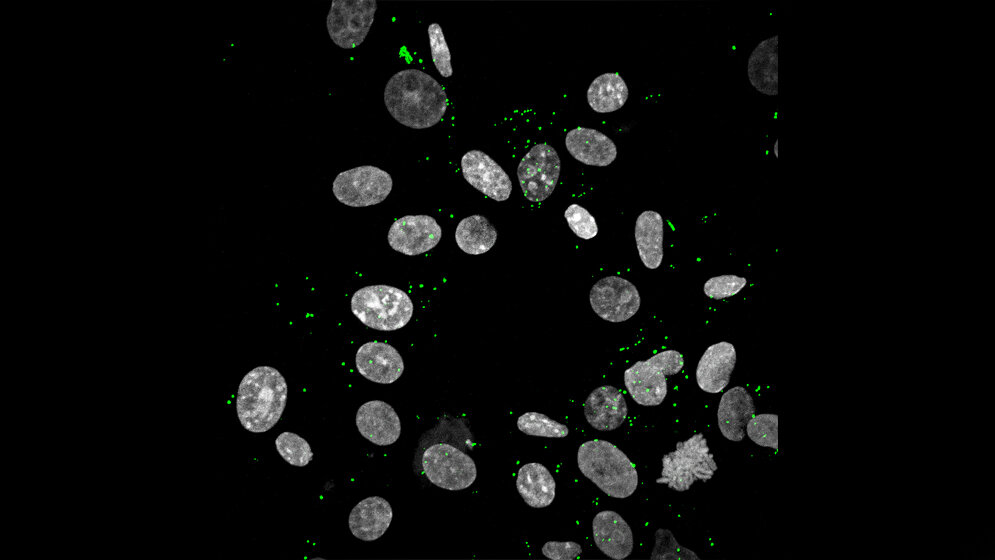 Zika_Viren_docken_an_Zellen_an_grau_Molekulare_Virologie_Uni_Ulm.jpg Zika-Viren