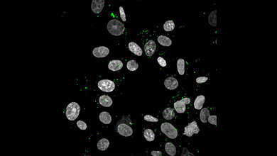 Zika_Viren_docken_an_Zellen_an_grau_Molekulare_Virologie_Uni_Ulm.jpg Zika-Viren