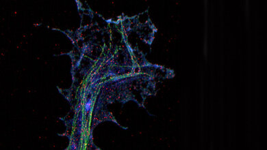 ALS_Axonterminale_eines_kultivierten_Motoneurons_Preeti_Yadav_Michael_Sendtner26072016.jpg Hochauflösende Mikroskopie einer Axonterminale