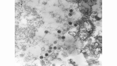 Epstein_Barr_Virus_EBV_Virionen_CDC__Dr_Fred_Murphy_public_domain.jpg Epstein-Barr-Virus